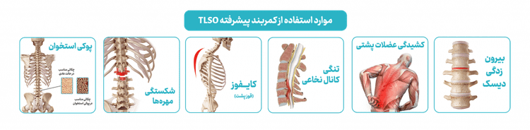 کمربند طبی TLSO اورتینو