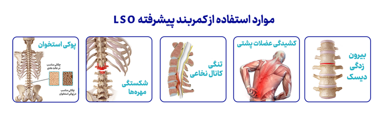 کمربند طبی LSO اورتینو