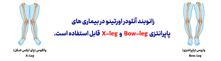 زانوبند آنلودر (زانوبند آرتروز و پای پرانتزی)